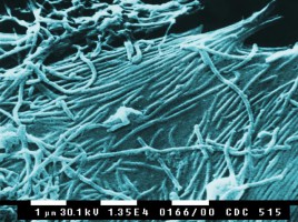Ebola_Virus-CDC