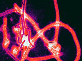 Ebola_virus_particles