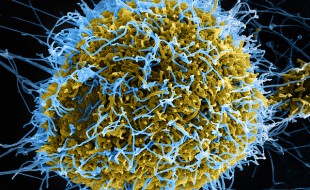 ebola-niaid-2