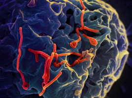 ebola-virus-niaid